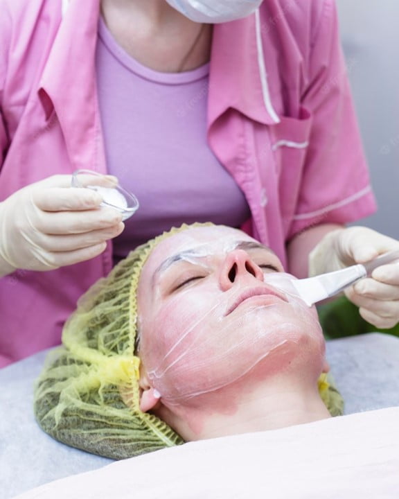 Chemical Peels Course pic