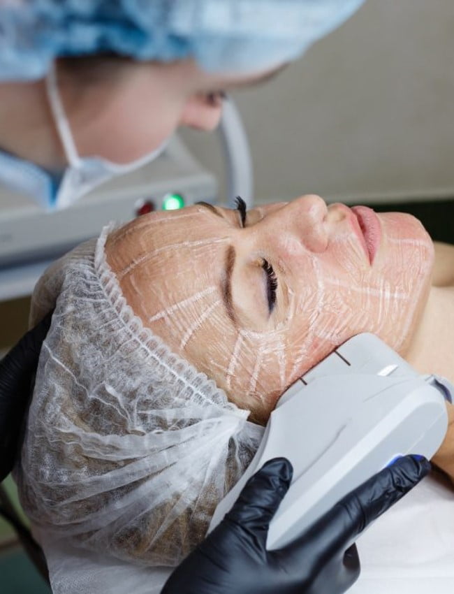 Non-Surgical Face Lifting Treatment pic2